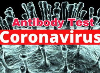 भारत में मई के अंत तक शुरू होगा एबॉट का एंटीबॉडी टेस्ट