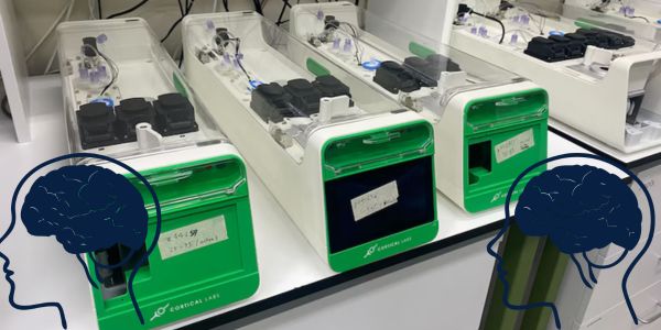World’s First Biological Computer Using Human Brain Cells Launched by Australian Startup