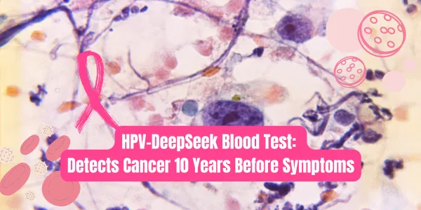 HPV-DeepSeek Blood Test Detects Head and Neck Cancer Up to 10 Years Early